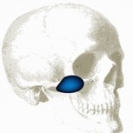 cheek-implants-indianapolis-dr-barry-eppley3