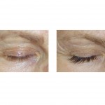 eye-lash-extensions-indianapolis-ology-spa-dr-barry-eppley