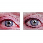 permanent-makeup-micropigmentation-indianapolis-dr-barry-eppley