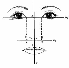 rhinoplasty-alar-width-dr-barry-eppley-indianapolis