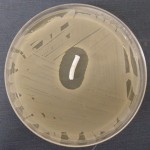 implant-with-antibiotics-dr-barry-eppley-indianapolis