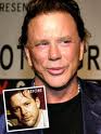 bad-plastic-surgery-in-men-dr-barry-eppley-indianapolis