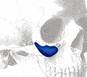 cheek-implants-for-midface-lifting-dr-barry-eppley-indianapolis
