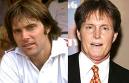 unnatural-plastic-surgery-in-men-dr-barry-eppley-indianapolis1
