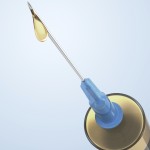 injectable-fillers-face-indianapolis-dr-barry-eppley