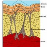 cellulite-anatomy-dr-barry-eppley-indianapolis