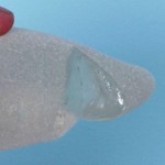 gummy-bear-breast-implants-indianapolis-dr-barry-eppley