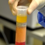 centrifuged-fat-preparation-for-fat-injections-dr-barry-eppley-indianapolis