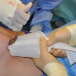 funnel-breast-augmentation-dr-barry-eppley-indianapolis2