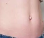 outie-belly-button-surgery-dr-barry-eppley-indianapolis