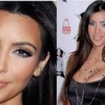 celebrity-plastic-surgery-indianapolis-dr-barry-eppley1