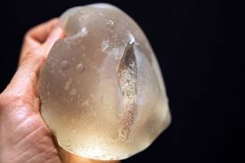 pip-breast-implant-ruptures-dr-barry-eppley-indianapolis
