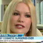 world-record-plastic-surgery-dr-barry-eplpey-indianapolis