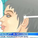 facelift-bungee-indianapolis-dr-barry-eppley4