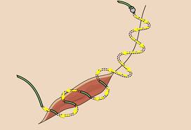 subcuticular-suturing-dr-barry-eppley-indianapolis