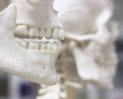 Facial Bone Resorption with Aging Dr Barry Eppley Indianapolis