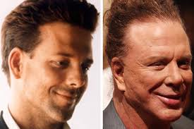 Celebrity Plastic Surgery Dr Barry Eppley Indianapolis