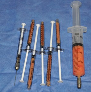 Fat Injection Syringes Dr Barry Eppley Indianapolis
