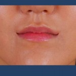 mouth-surgery.png