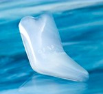 Jaw angle implants Dr Barry Eppley Indianapolis
