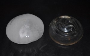 Breast Implants and Freezing Dr Barry Eppley Indianapolis