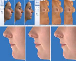 Computer Imaging in Plastic Surgery Dr Brry Eppley Indianapolis