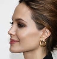 Angelina Jolie Square Jaw Angle Dr Barry Eppley Indianapolis