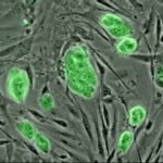 Stem Cells and fat Injections Dr Barry Eppley Indianapolis