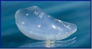 Tear Trough Implants Dr Barry Eppley Indianapolis