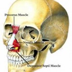 Depressor Septi Nasi Muscle in Rhinoplasty Dr Barry Eppley Indianapolis