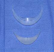 Chin Implant with lateral wings compared to a central button chin implant Dr Barry Eppley Indianapolis
