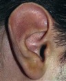 macrotia
