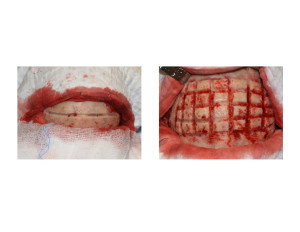 Skull Reduction technique 1 Dr Barry Eppley Indianapolis