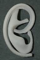 medpor-ear-framework-dr-barry-eppley-indianapolis