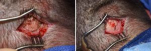 occipital-knob-reduction-by-burring-dr-barry-eppley-indianapolis