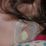 earwell-ear-molding-system-dr-barry-eppley-indianapolis
