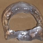 Forehead Bony defect model Dr Barry Eppley Indianapolis