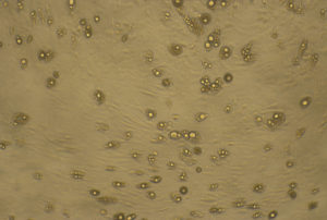 Adipocyte cell cultures Dr Barry Eppley Indianapolis